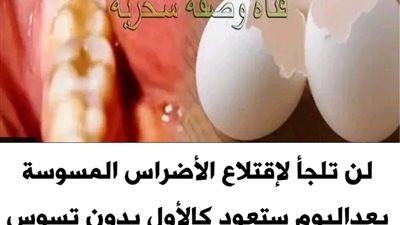 لن تلجأ لإقتلاع الأضراس المسوسة بعداليوم ستعود كالأول بدون تسوس ولا ثقب علاج تسوس الأسنان 