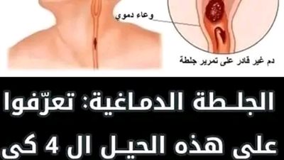 4 علامات مبكرة تشير إلى انسداد الشرايين-طرق الوقاية منها