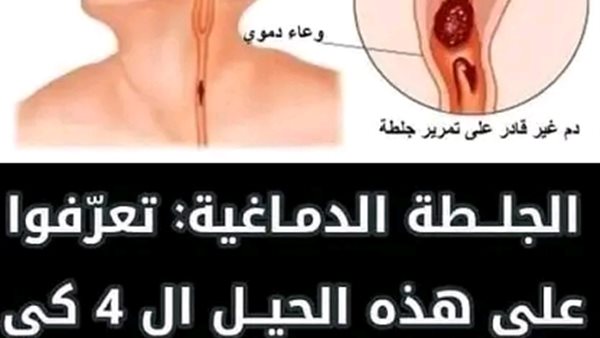 لمحة نيوز