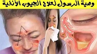 5 طرق طبيعية لعلاج التهابات الجيوب الأنفية.. ومفاجأة بشأن وصية رسول الله 