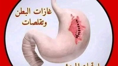علاج القولون العصبي 