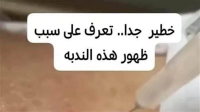 تعرف على سبب ظهور هذه الندبه