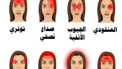 انواع الصداع 