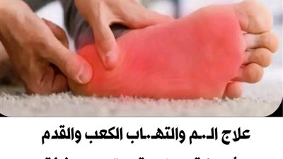 وداعا الــم والتهــــاب القدم  عـــلاج الــــم والتهــــاب الكعب والقدم والشــــوكة العظمية والتهــــاب اللفافة الأخمــــصية