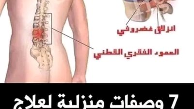 كيف تتخلصين من آلام الظهر 