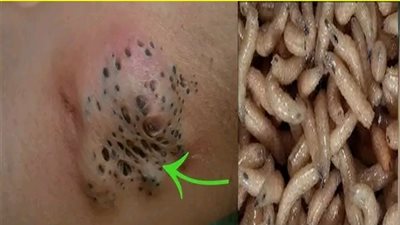  هل تعرف ما هي أقذر منطقة في جسم الإنسان؟  يجب تنظيفها يوميًا لتجنب الأمراض والمشاكل الصحية!  