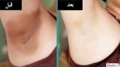 أقوى وصفه طبيعيه لتفتيح المناطق الحساسه  