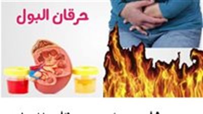 علاج حرقان البول