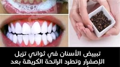 الوصفة المعجزة لتبييض الاسنان في ربع ساعه و من اول استعمال وصفة بمكونات رخيصة